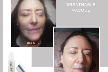 Ann – Skincerity before after