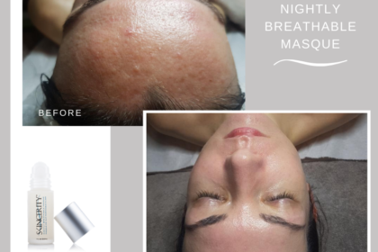 Lonan – Skincerity before after